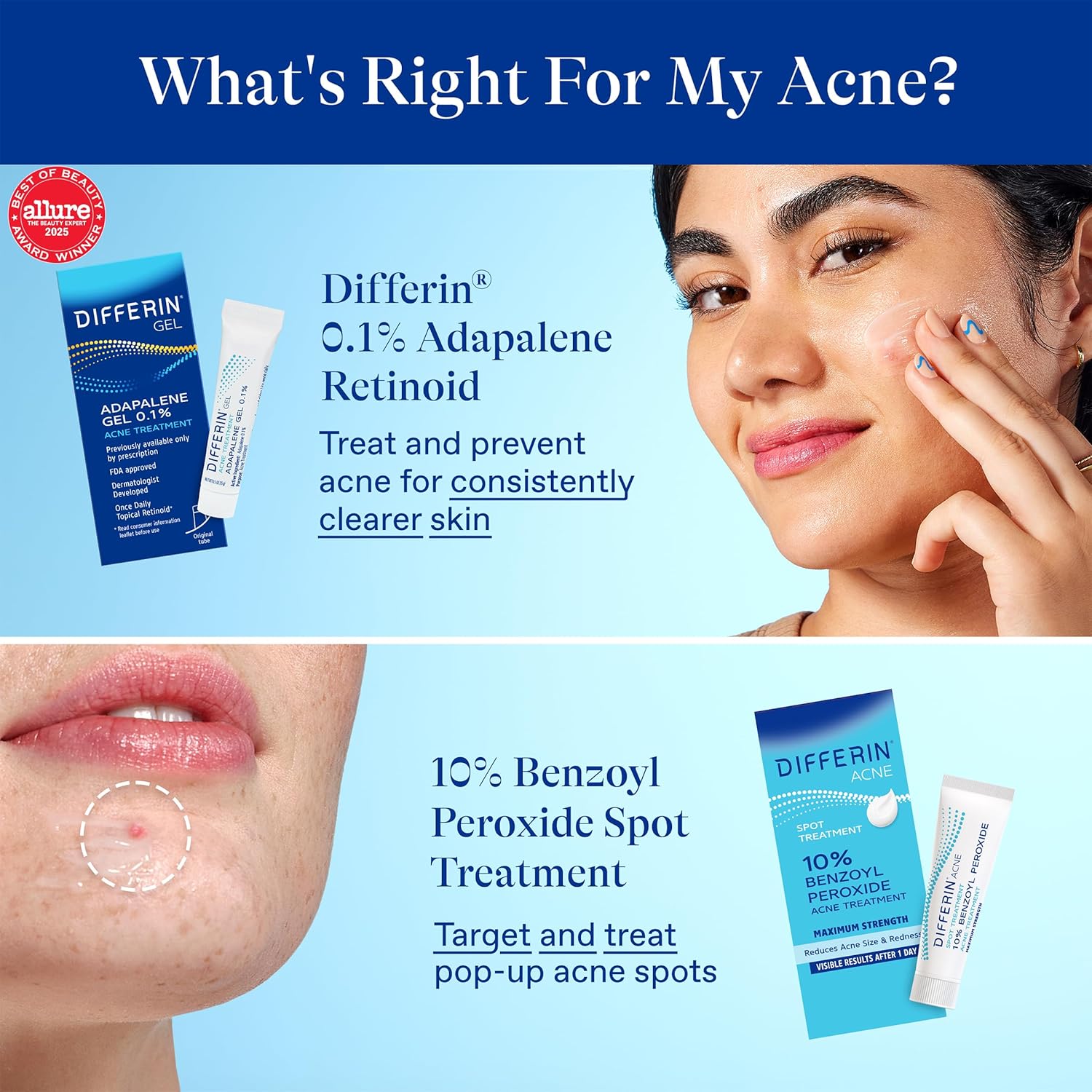 디페린 벤조일퍼옥사이드 10% 스팟 트리트먼트 1 oz – 빠르게 트러블을 완화하는 스팟 케어