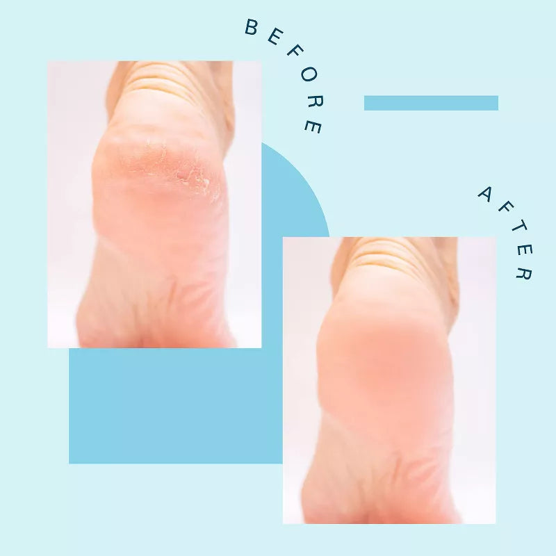 M3 내추럴스 티트리 오일 풋 소크 16 oz – 티트리 오일 함유 발 전용 입욕제